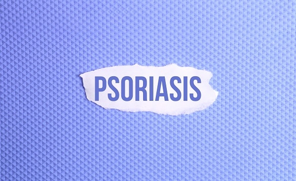 Psoriasis