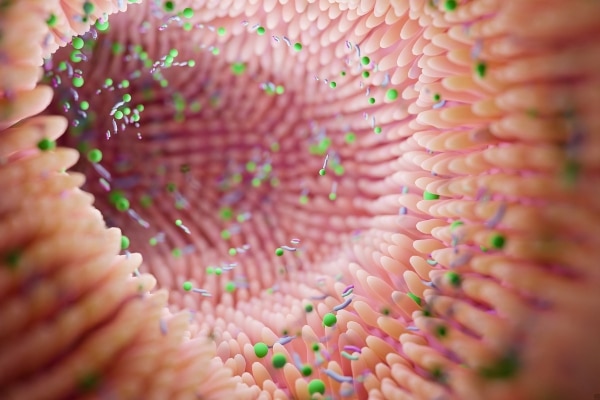 Probiotics in Weight Management